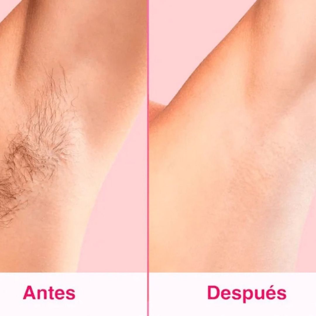 Depiladora Laser Portatil Ipl
