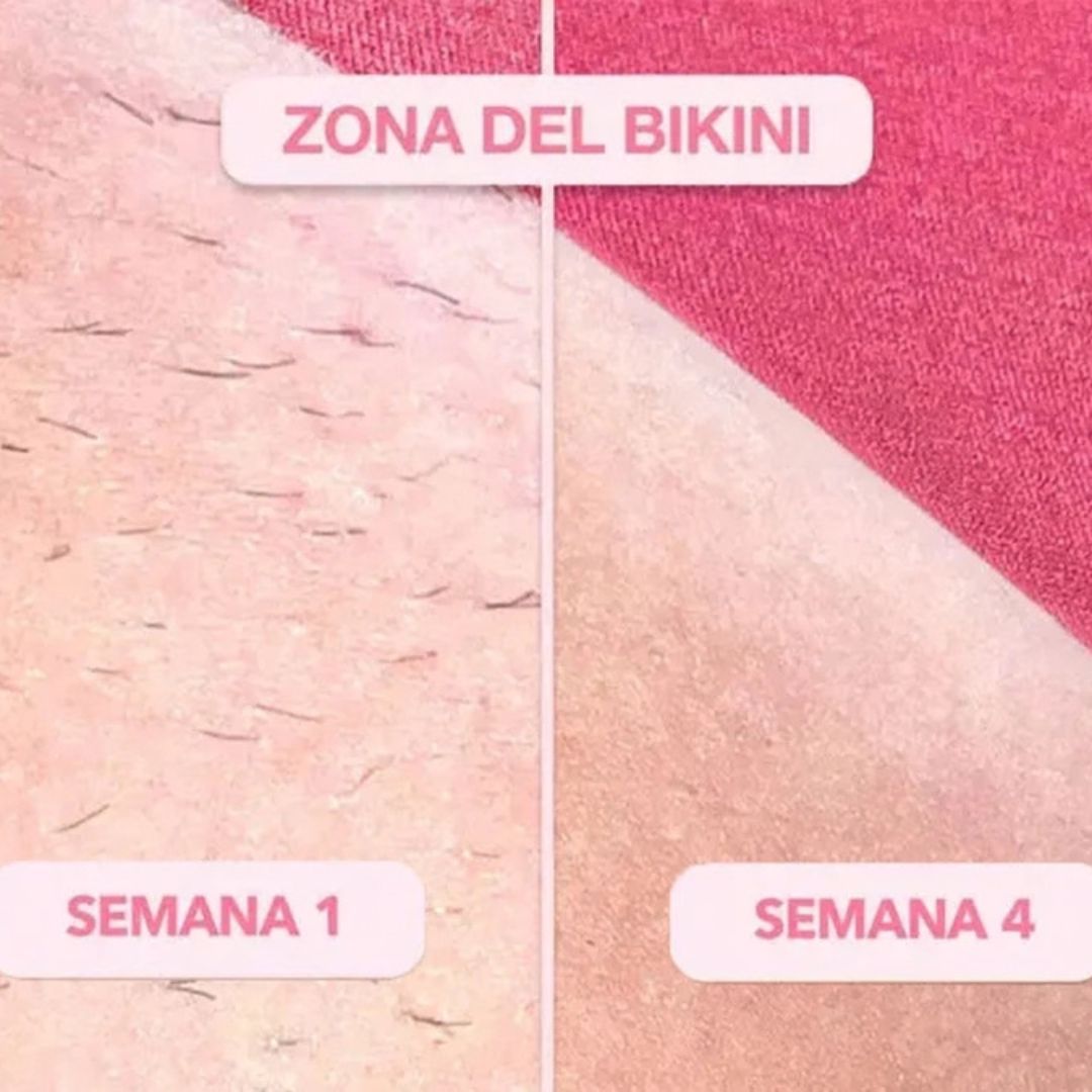 Depiladora Laser Portatil Ipl