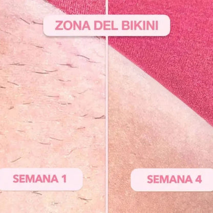 Depiladora Laser Portatil Ipl